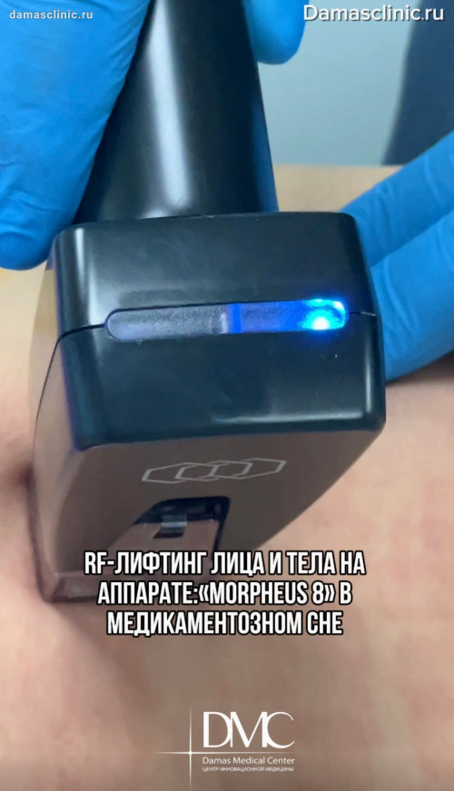 Косметологические процедуры под наркозом (в медикаментозном сне)