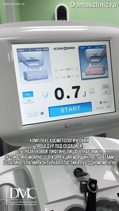 Комплекс косметологических процедур под седацией: ультразвуковой лифтинг лица ULTRAFORMER, RF-лифтинг MORPHEUS 8, коррекция морщин препаратами ботулинотерапии и контурная пластика губ одномоментно в процессе