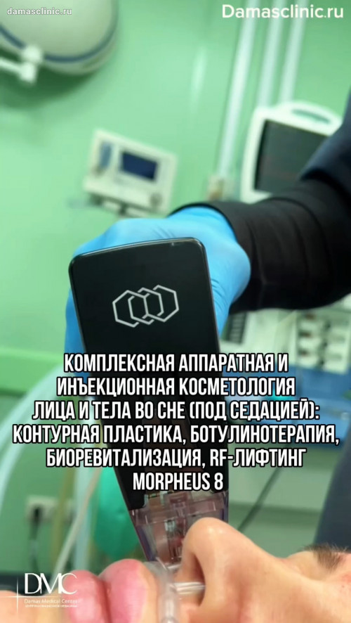 Комплексная аппаратная и инъекционная косметология лица и тела во сне (под седацией): контурная пластика, ботулинотерапия, биоревитализация, RF-лифтинг MORPHEUS 8