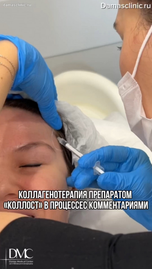 Коллагенотерапия препаратом «Коллост» в процессе с комментариями доктора. Показания и противопоказания с видео в процессе