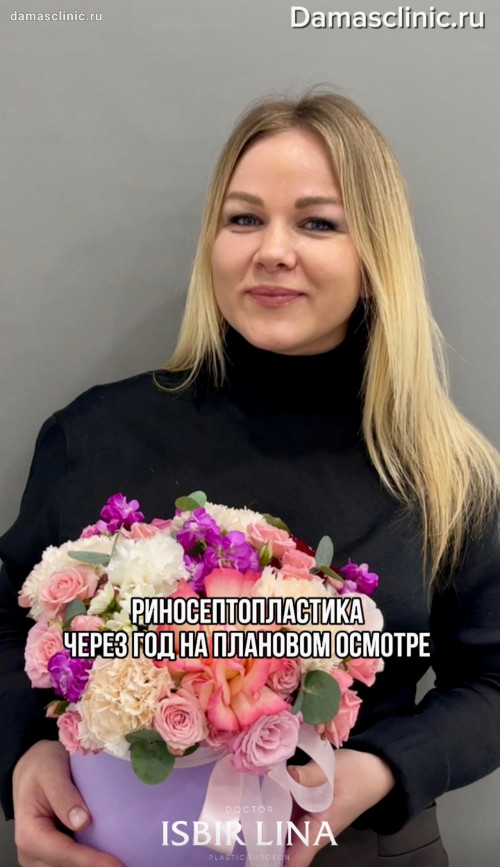 Отзыв после риносептопластики через год