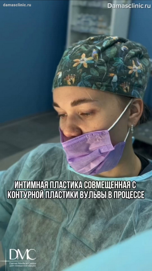 Пластика малых половых губ, пластика клитора и коррекция спайки в процессе с видео и комментариями доктора