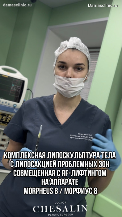 Комплексная липоскульптура тела с липосакцией проблемных зон, совмещенная с RF-лифтингом на аппарате MORPHEUS 8 / МОРФИУС 8