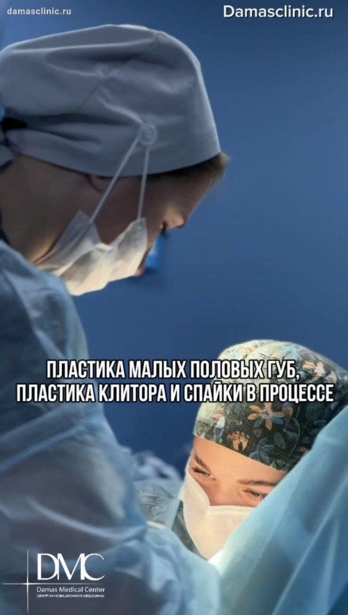 Линейная пластика клитора с одномоментной клиновидной пластикой малых половых губ и пластика спайки: до и сразу после с фото-результатом