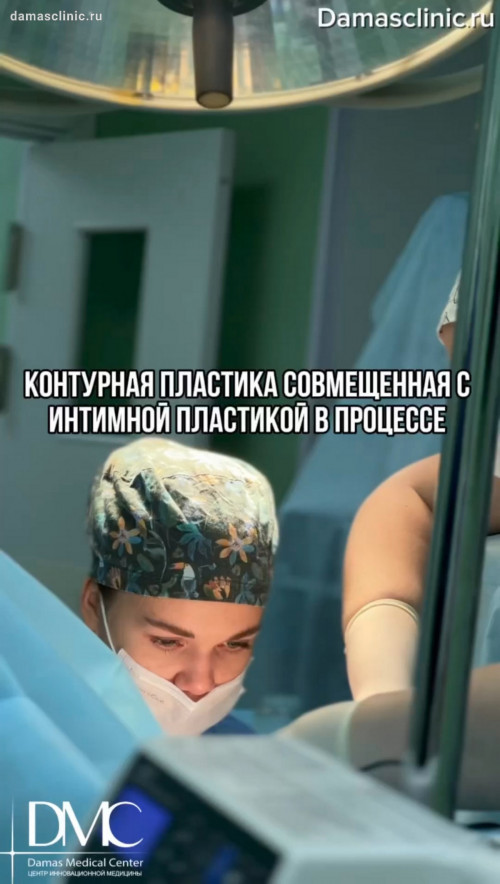 Контурная пластика, совмещенная с интимной пластикой в процессе