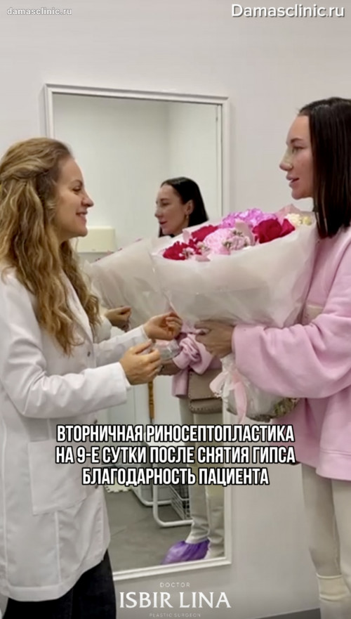 Вторичная риносептопластика на 9-е сутки после снятия гипса. Отзыв пациента