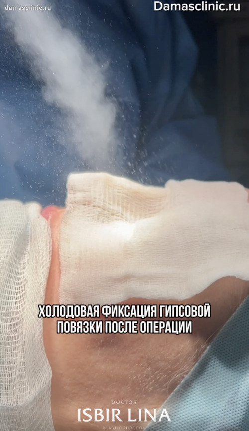 Холодовая фиксация гипсовой повязки после операции