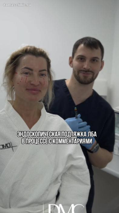 Эндоскопическая подтяжка лба в процессе с комментариями с видео процесса