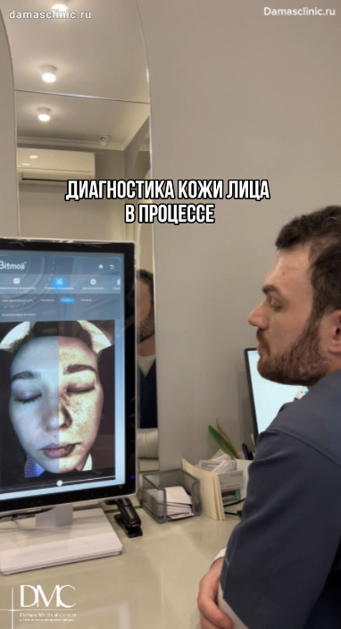Диагностика кожи лица в процессе в рамках дерматологического приема
