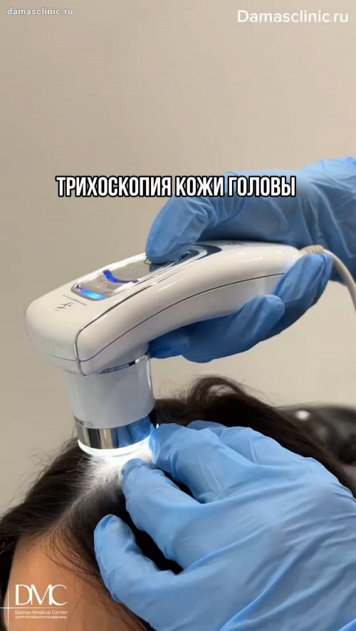 Трихоскопия кожи головы. Показания и диагностика в Damas Medical Center