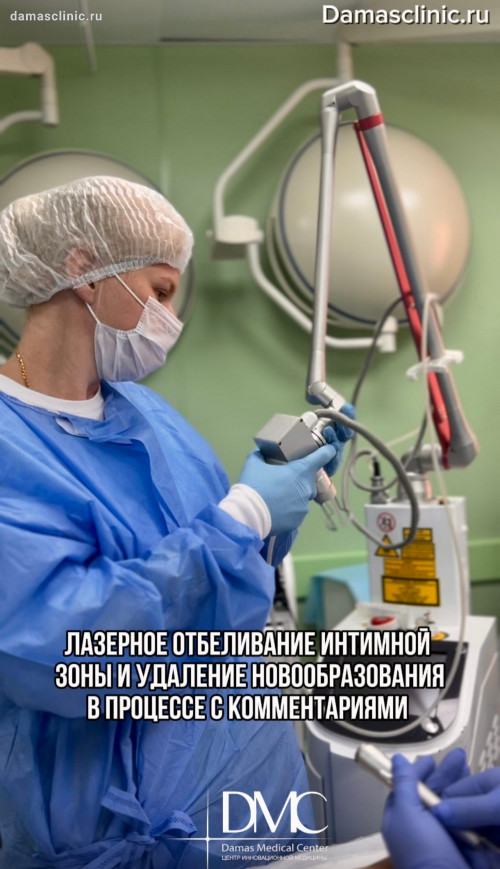 Лазерное отбеливание интимной зоны и удаление новообразования: в процессе с комментариями доктора в видео