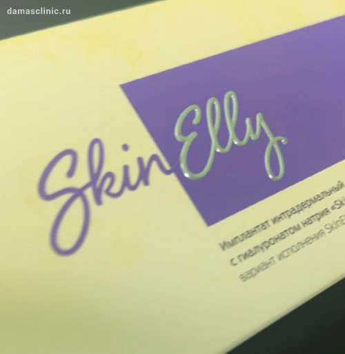 Контурная пластика больших половых губ препаратом Skinelly middle (2 мл). Результат сразу после процедуры