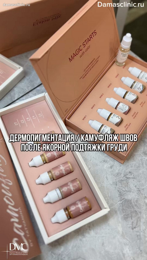 Дермопигментация - камуфляж швов после якорной подтяжки груди с фото и видео